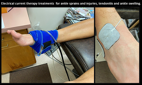 electrical current therapy treatments for ankle sprains and injuries, tendonitis and ankle swelling